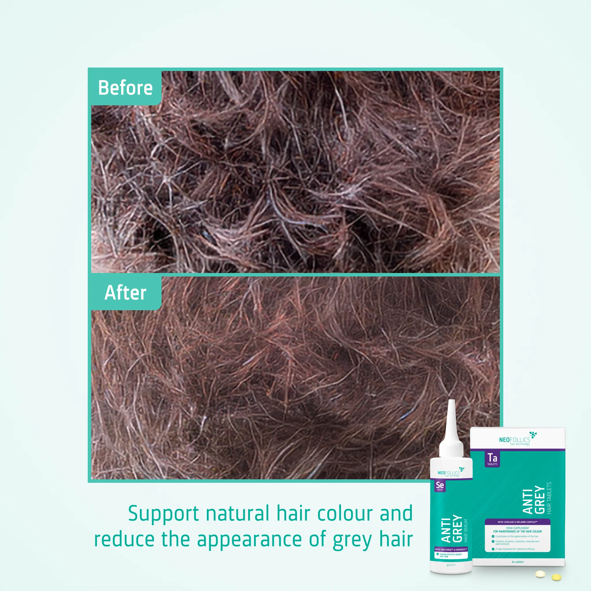 Neofollics Anti Grey treatment - Image 5