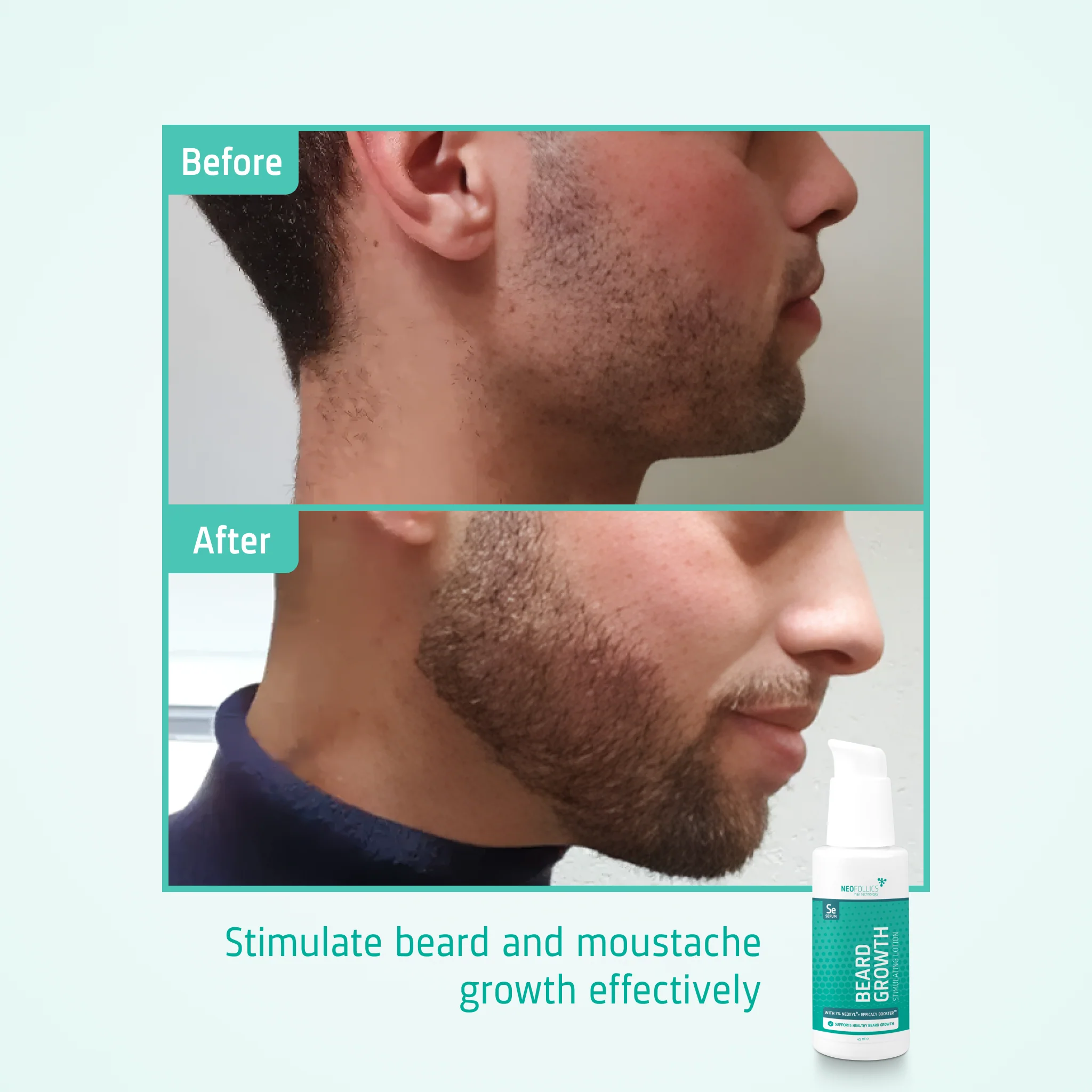Beard Growth Stimulating Serum - Image 4