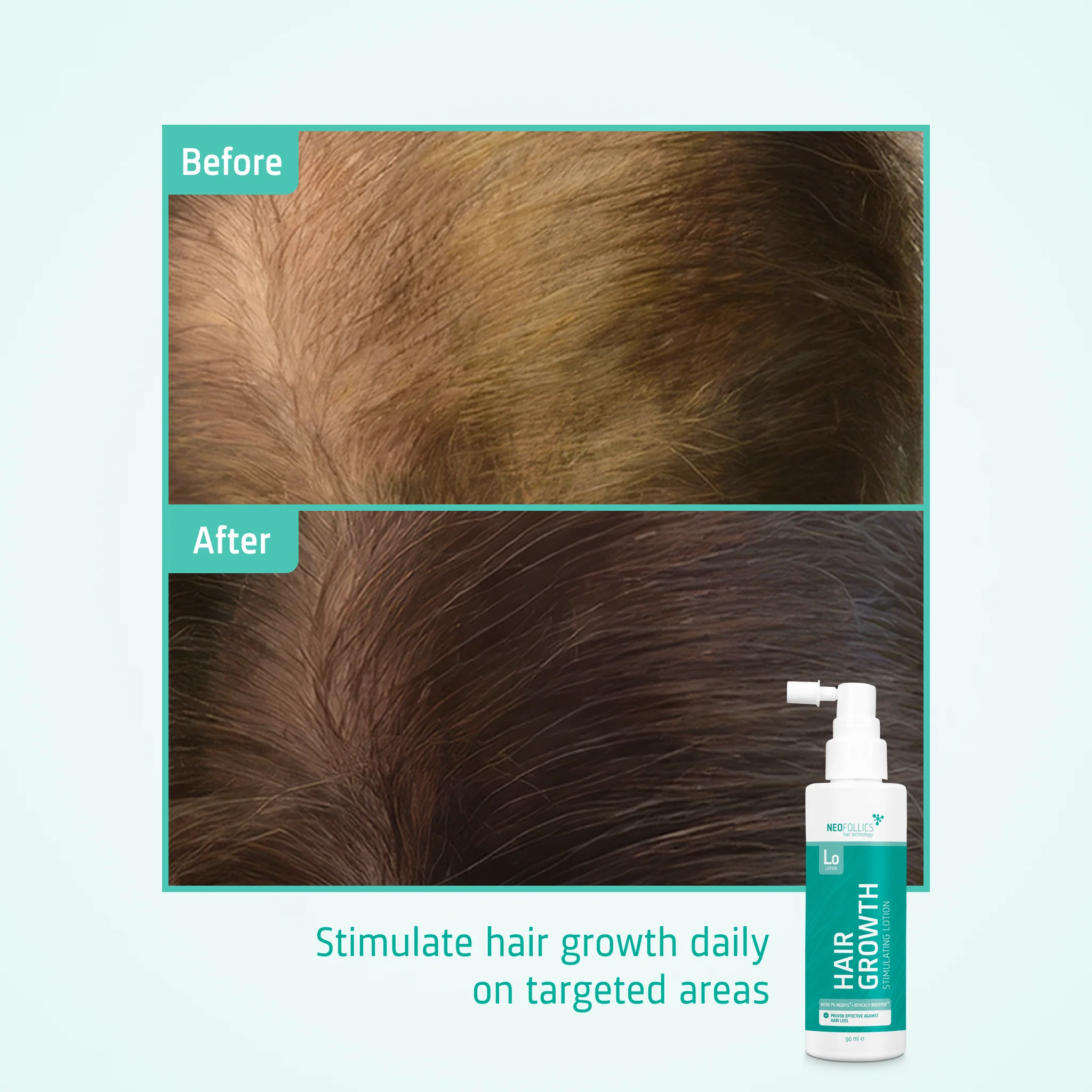 Hair Growth Stimulating Lotion - Image 6