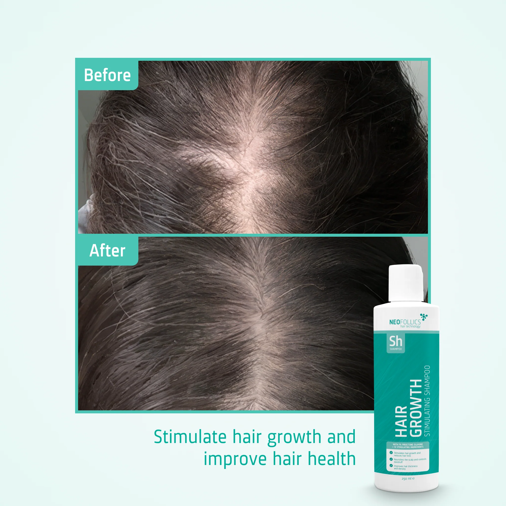 Hair Growth Stimulating Shampoo - Image 6