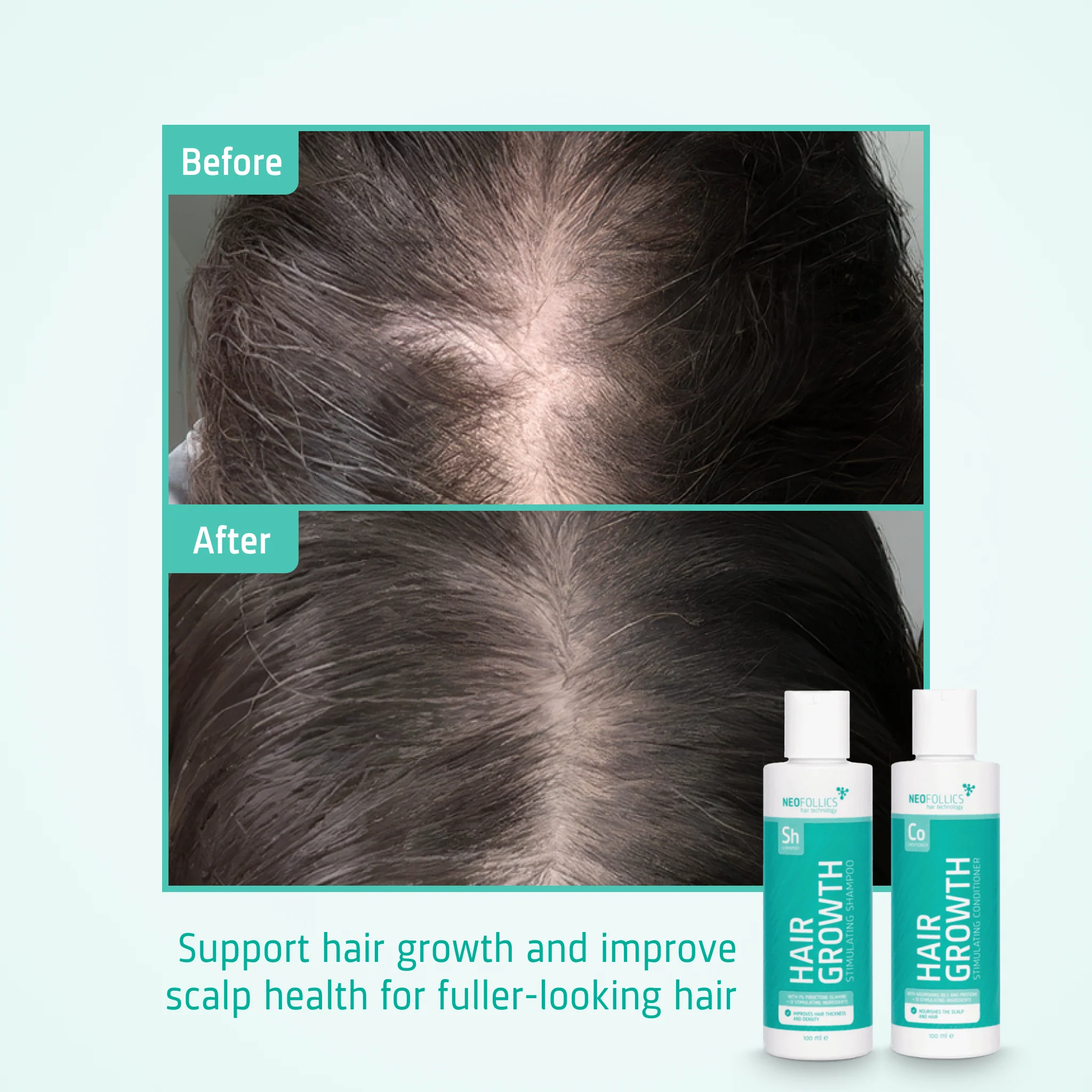 Hair Growth Stimulating Starter Kit - Image 5