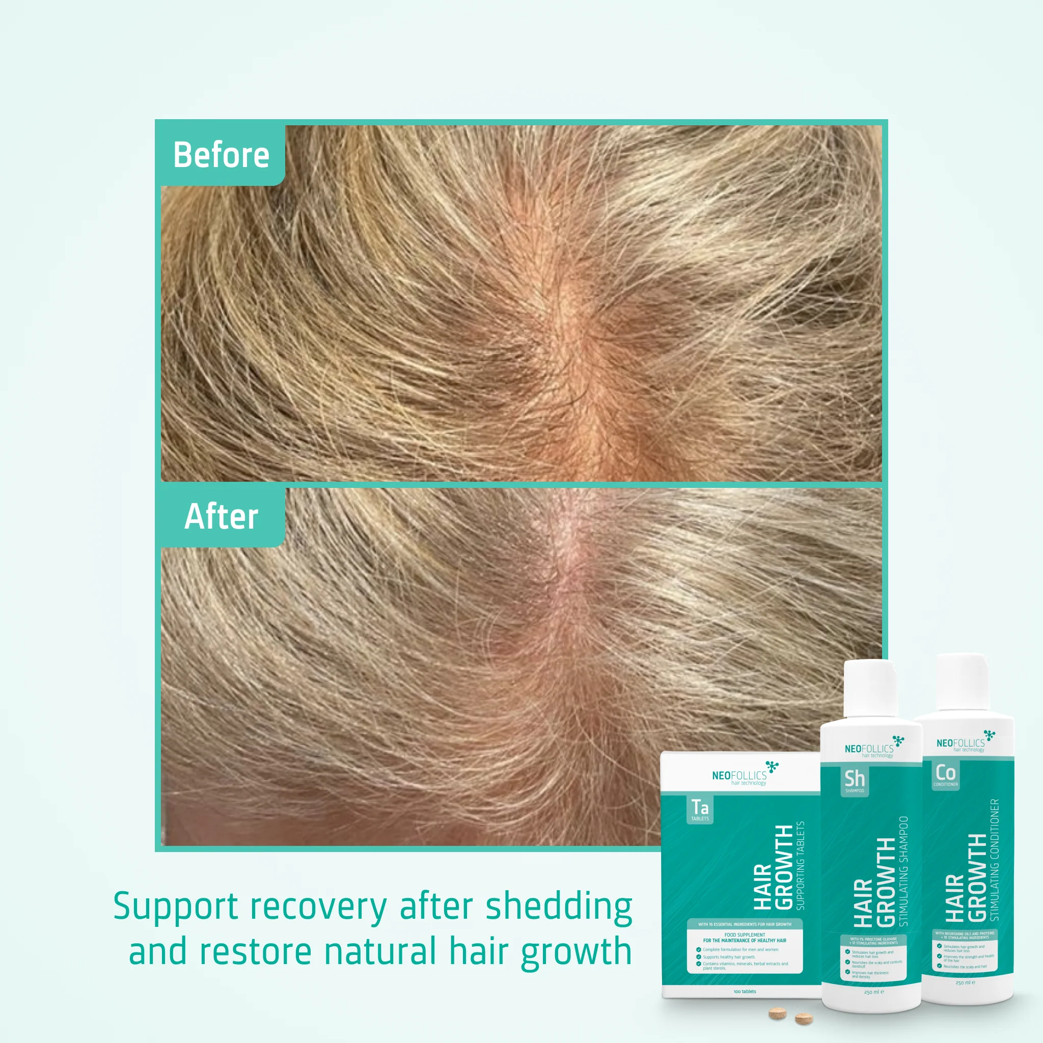 After Telogen Effluvium routine - Image 5