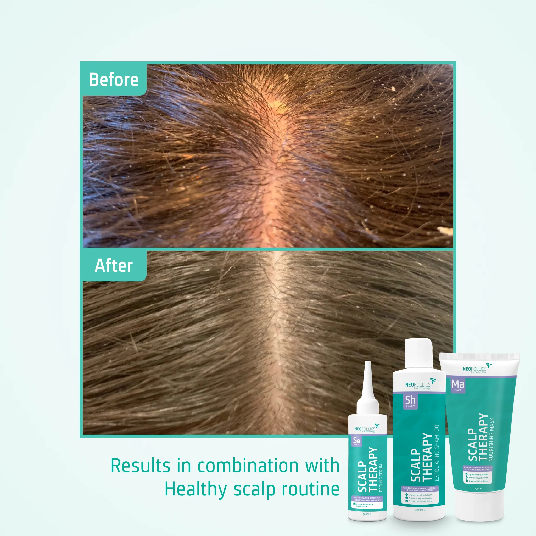 Scalp Massaging Shampoo Brush - Image 6