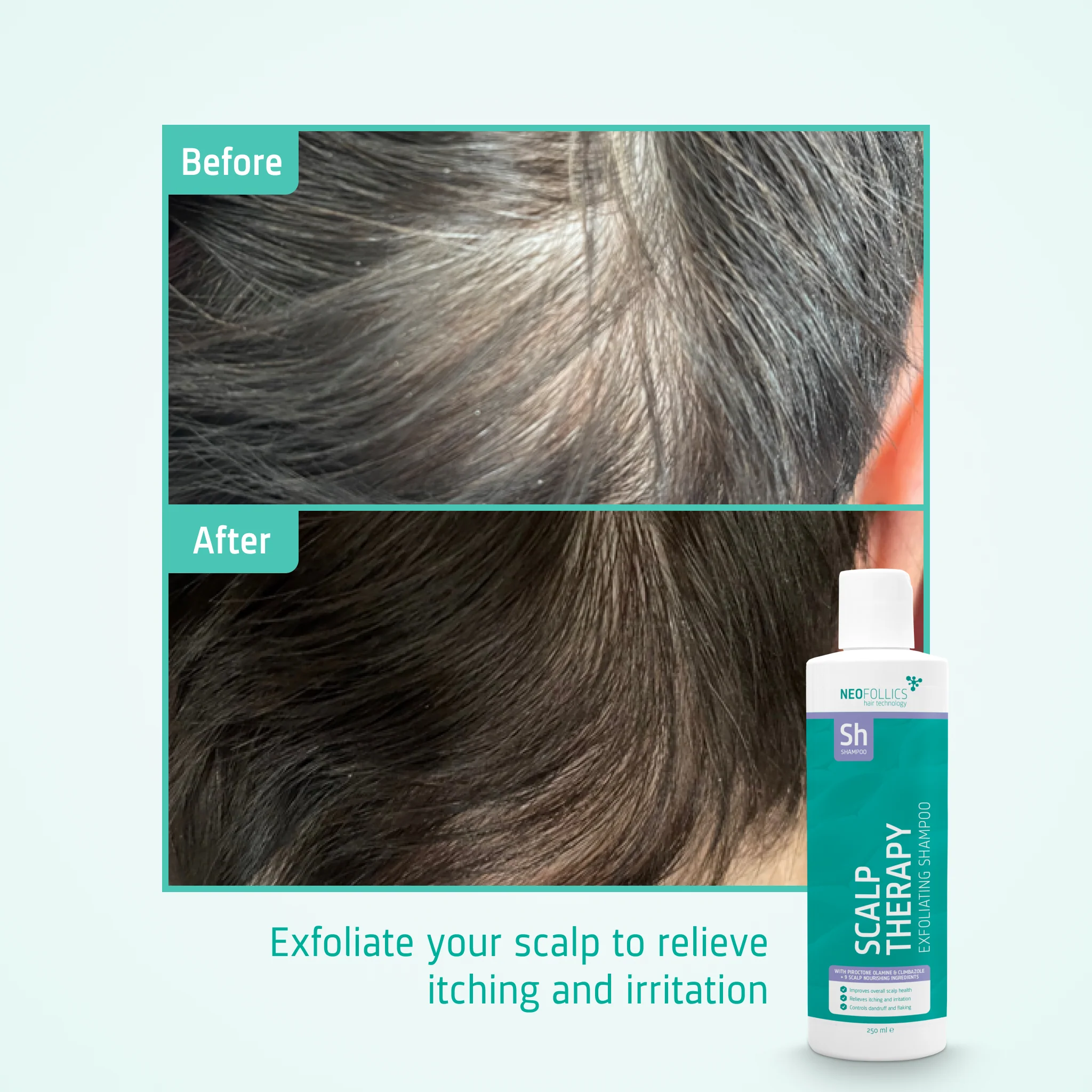 Scalp Therapy Exfoliating Shampoo - Image 6
