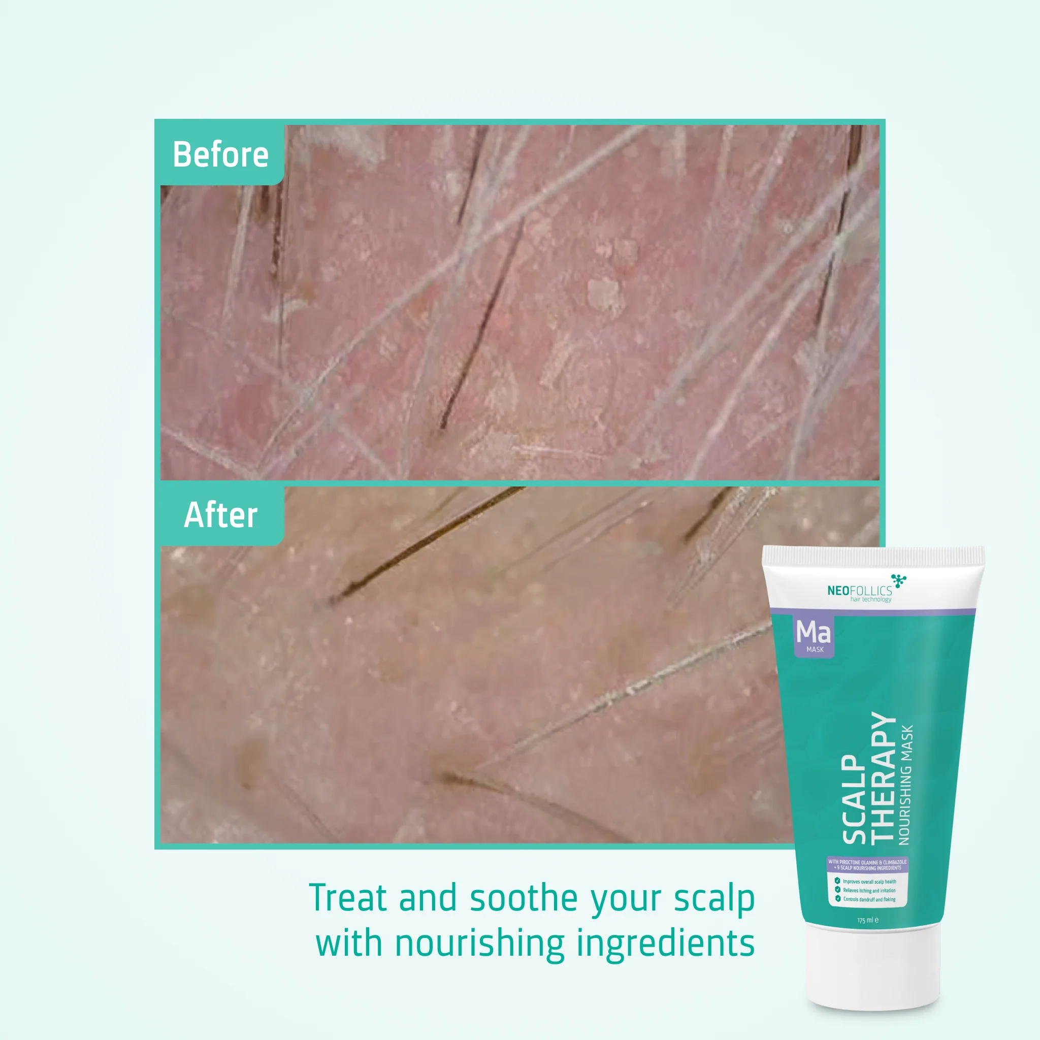 Scalp Therapy Nourishing Mask - Image 6