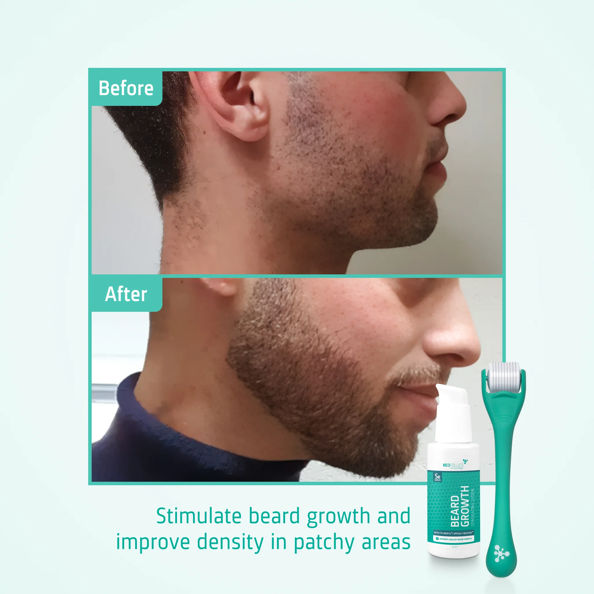 Beard Growth kit - Image 5