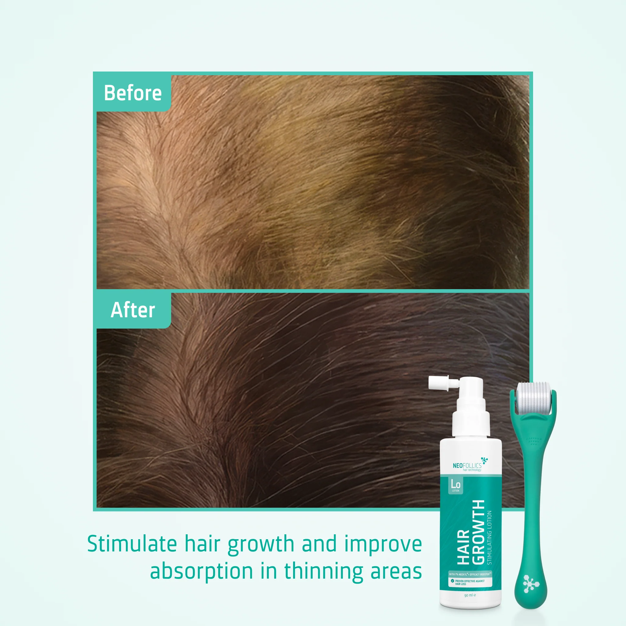 Hair Growth kit - Image 5