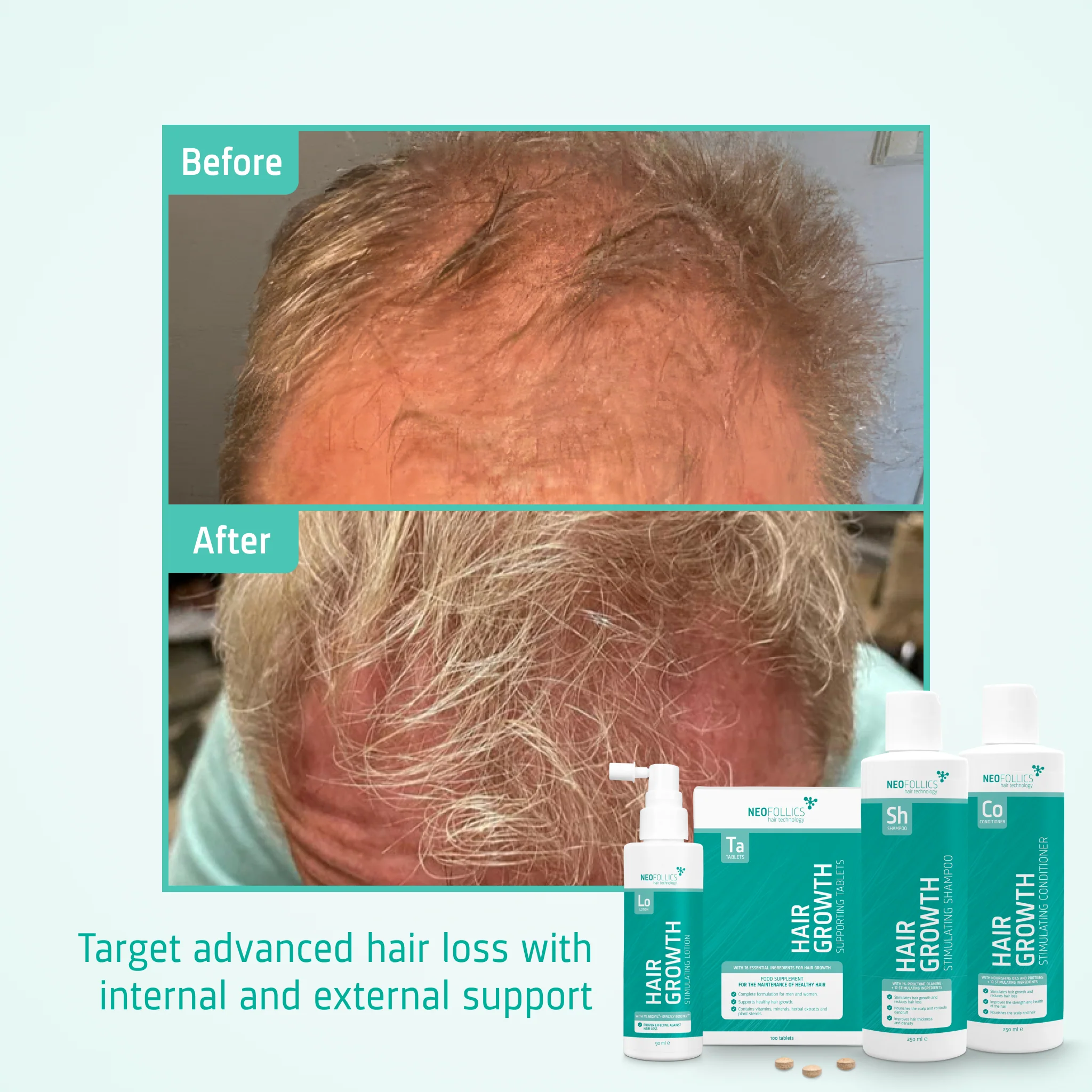 Advanced hair loss treatment - Image 5