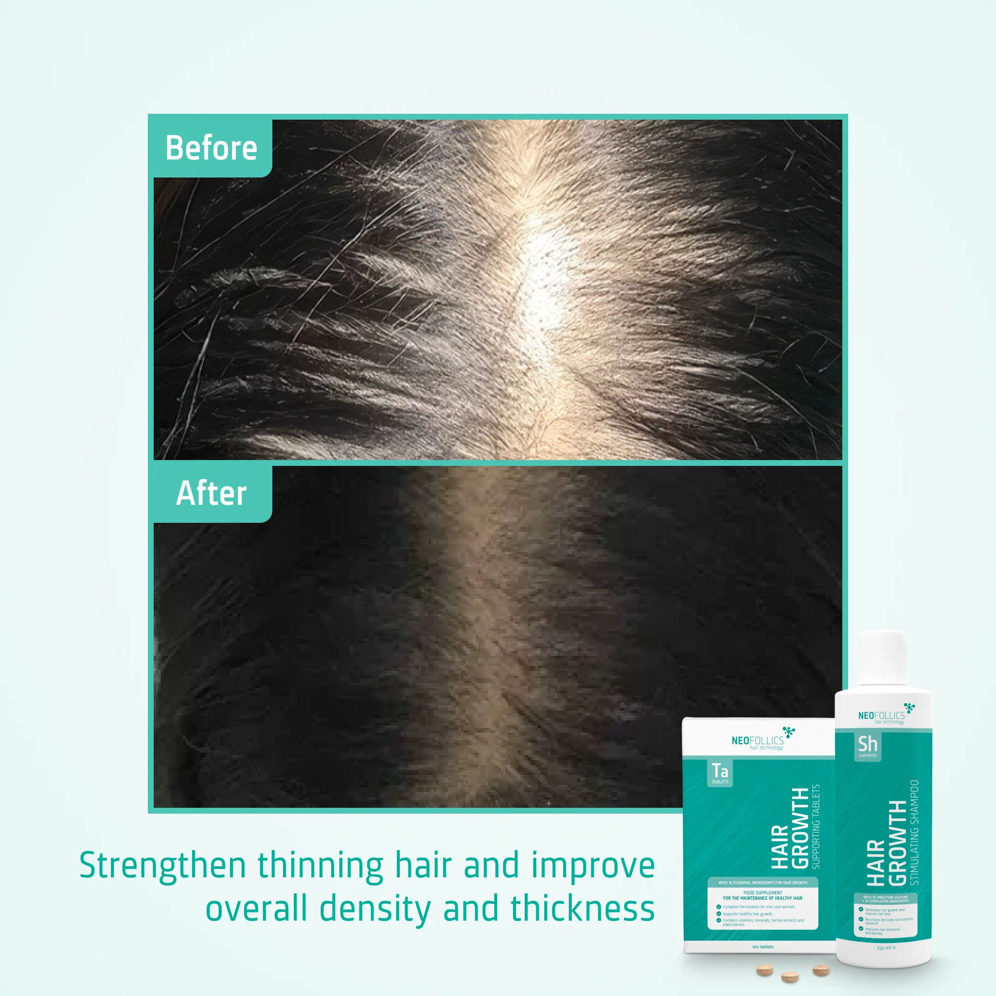 Thinning hair treatment - Image 5