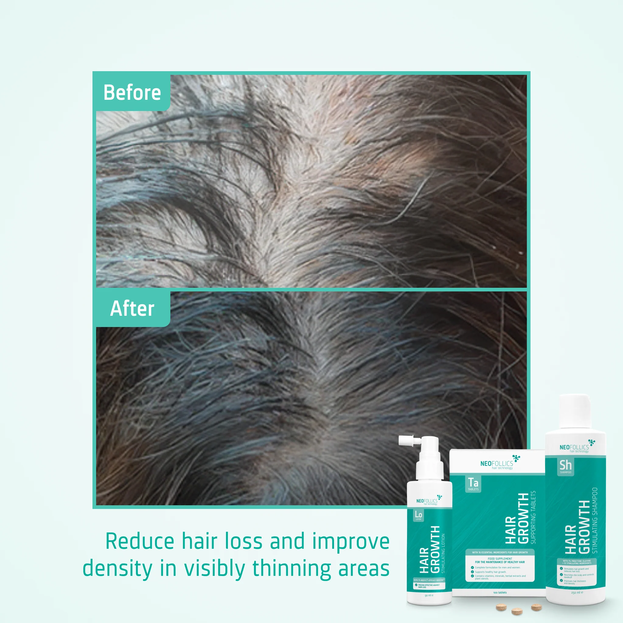 Moderate hair loss treatment - Image 5